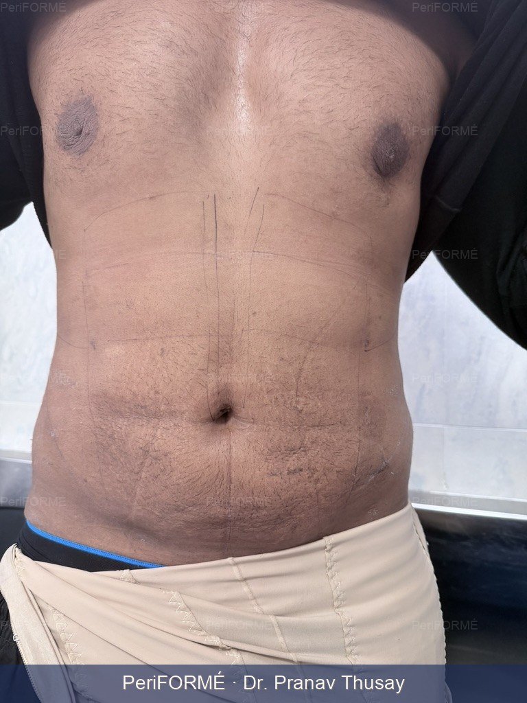 6 pack creation