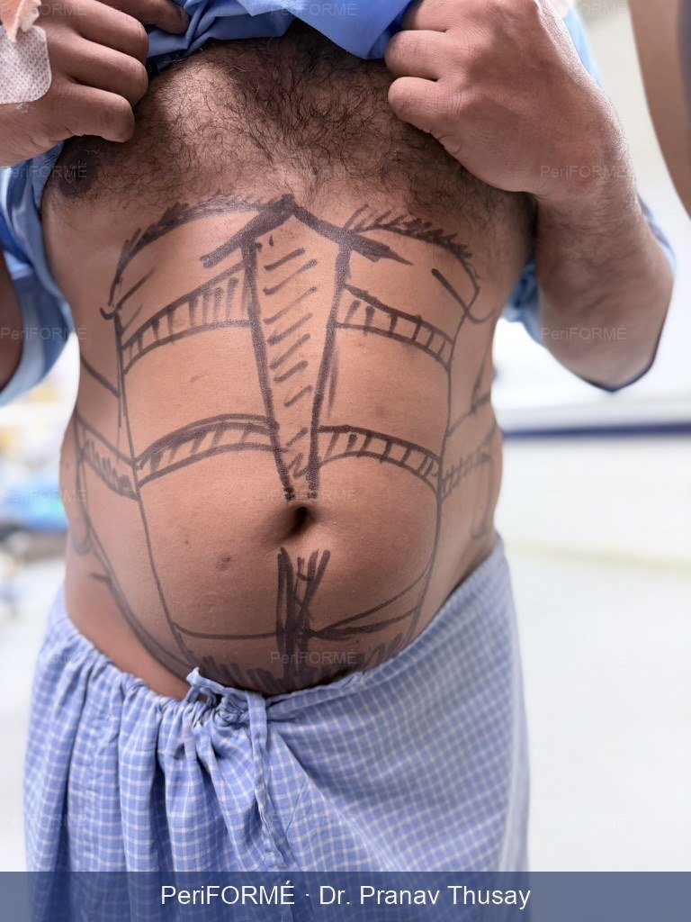 6 pack creation — Before