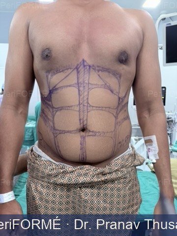 6 pack creation — Before