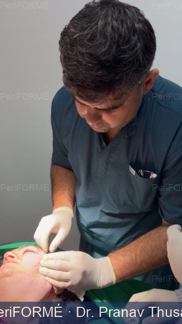 Nonsurgcial facelift